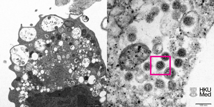 Перше фото штаму коронавірусу "Омікрон"